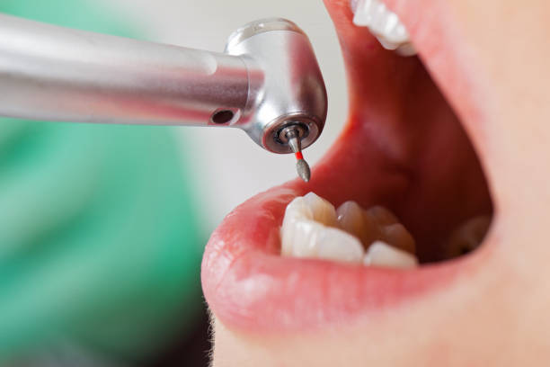 Best Emergency Gum Pain Relief  in Canton, MO